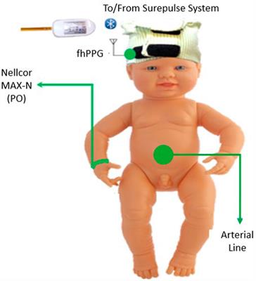 Forehead monitoring of heart rate in neonatal intensive care